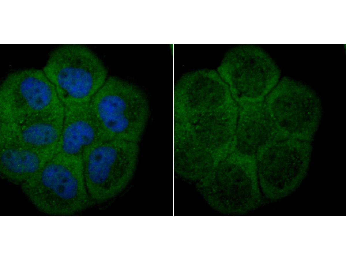 ICC staining Apg7 in A431 cells (green). The nuclear counter stain is DAPI (blue). Cells were fixed in paraformaldehyde, permeabilised with 0.25% Triton X100/PBS.