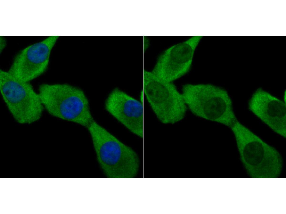 ICC staining Apg7 in A549 cells (green). The nuclear counter stain is DAPI (blue). Cells were fixed in paraformaldehyde, permeabilised with 0.25% Triton X100/PBS.
