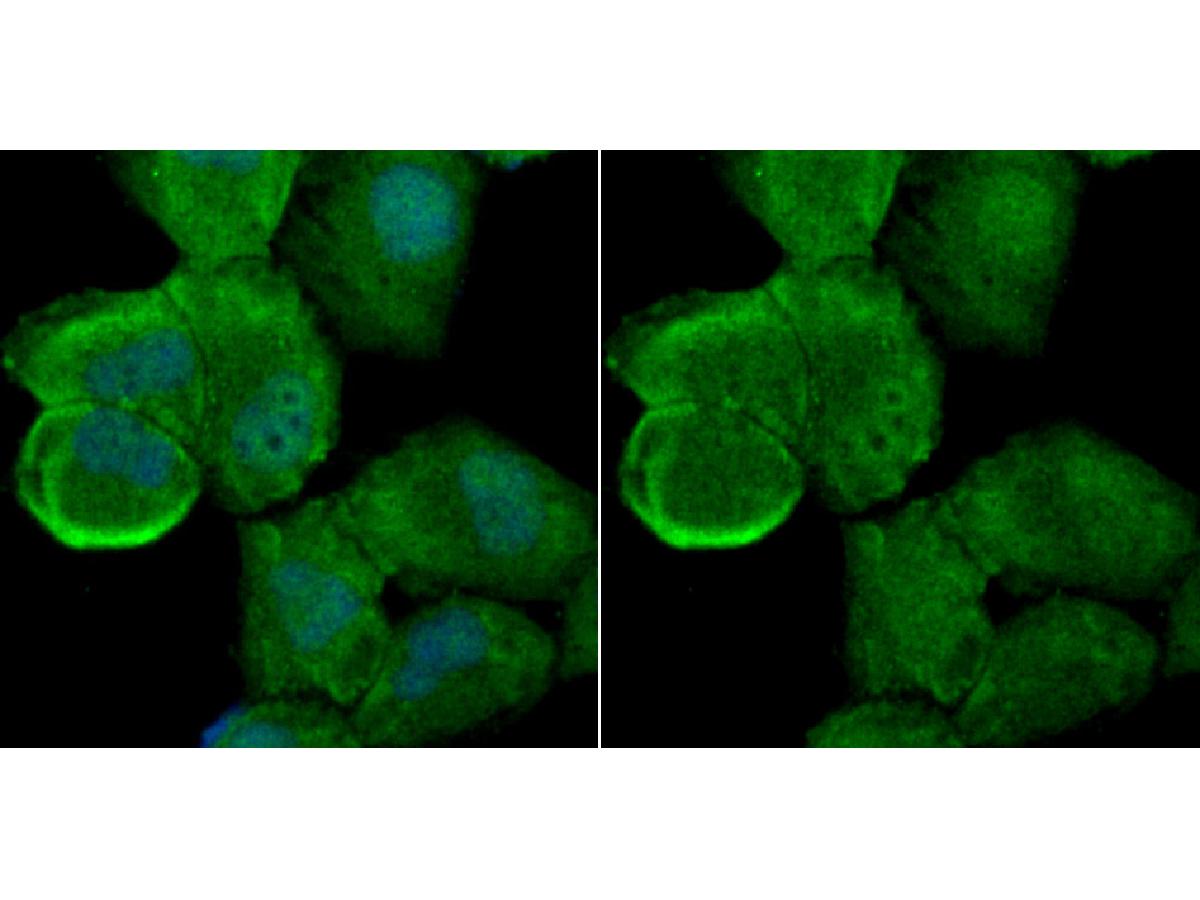 ICC staining Apg7 in HUVEC cells (green). The nuclear counter stain is DAPI (blue). Cells were fixed in paraformaldehyde, permeabilised with 0.25% Triton X100/PBS.