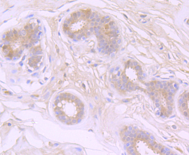 Immunohistochemical analysis of paraffin-embedded human breast tissue using anti-Apg7 antibody. Counter stained with hematoxylin.
