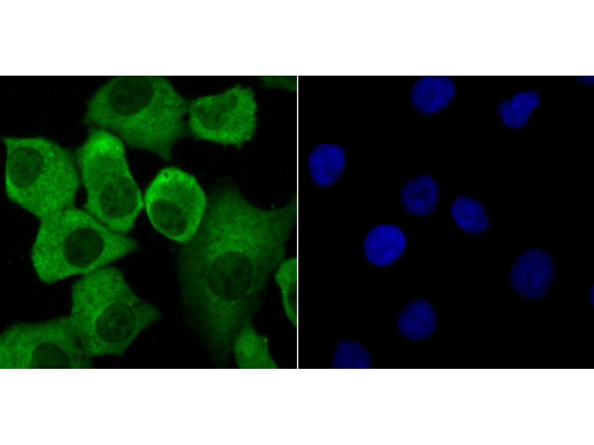 ICC staining Progesterone Receptor in A549 cells (green). The nuclear counter stain is DAPI (blue). Cells were fixed in paraformaldehyde, permeabilised with 0.25% Triton X100/PBS.