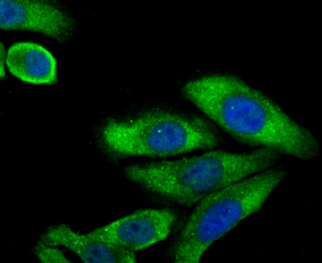 ICC staining of LC3A in HepG2 cells (green). Formalin fixed cells were permeabilized with 0.1% Triton X-100 in TBS for 10 minutes at room temperature and blocked with 1% Blocker BSA for 15 minutes at room temperature. Cells were probed with the primary antibody (ER1802-2, 1/50) for 2 hour at room temperature, washed with PBS. Alexa Fluor®488 Goat anti-Rabbit IgG was used as the secondary antibody at 1/1,000 dilution. The nuclear counter stain is DAPI (blue).