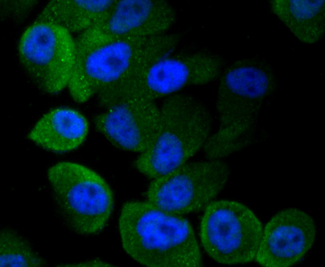 ICC staining of LC3A in PC-3M cells (green). Formalin fixed cells were permeabilized with 0.1% Triton X-100 in TBS for 10 minutes at room temperature and blocked with 1% Blocker BSA for 15 minutes at room temperature. Cells were probed with the primary antibody (ER1802-2, 1/50) for 2 hour at room temperature, washed with PBS. Alexa Fluor®488 Goat anti-Rabbit IgG was used as the secondary antibody at 1/1,000 dilution. The nuclear counter stain is DAPI (blue).