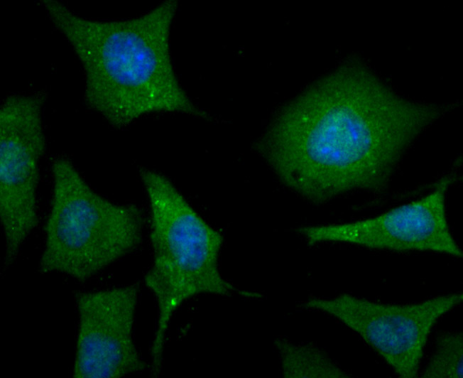 ICC staining of LC3A in SH-SY5Y cells (green). Formalin fixed cells were permeabilized with 0.1% Triton X-100 in TBS for 10 minutes at room temperature and blocked with 1% Blocker BSA for 15 minutes at room temperature. Cells were probed with the primary antibody (ER1802-2, 1/50) for 2 hour at room temperature, washed with PBS. Alexa Fluor®488 Goat anti-Rabbit IgG was used as the secondary antibody at 1/1,000 dilution. The nuclear counter stain is DAPI (blue).