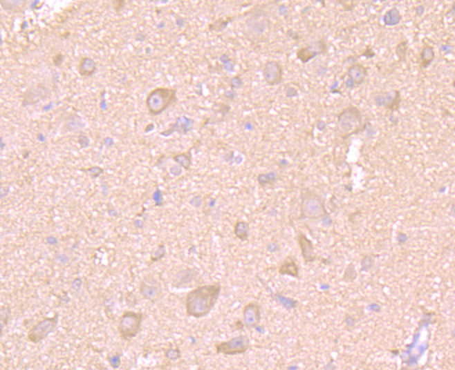 Immunohistochemical analysis of paraffin-embedded rat brain tissue using anti-LC3A antibody. The section was pre-treated using heat mediated antigen retrieval with Tris-EDTA buffer (pH 8.0-8.4) for 20 minutes.The tissues were blocked in 5% BSA for 30 minutes at room temperature, washed with ddH2O and PBS, and then probed with the primary antibody (ER1802-2, 1/50) for 30 minutes at room temperature. The detection was performed using an HRP conjugated compact polymer system. DAB was used as the chromogen. Tissues were counterstained with hematoxylin and mounted with DPX.