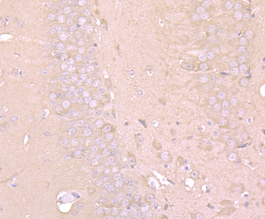Immunohistochemical analysis of paraffin-embedded mouse brain tissue using anti-LC3A antibody. The section was pre-treated using heat mediated antigen retrieval with Tris-EDTA buffer (pH 8.0-8.4) for 20 minutes.The tissues were blocked in 5% BSA for 30 minutes at room temperature, washed with ddH2O and PBS, and then probed with the primary antibody (ER1802-2, 1/50) for 30 minutes at room temperature. The detection was performed using an HRP conjugated compact polymer system. DAB was used as the chromogen. Tissues were counterstained with hematoxylin and mounted with DPX.