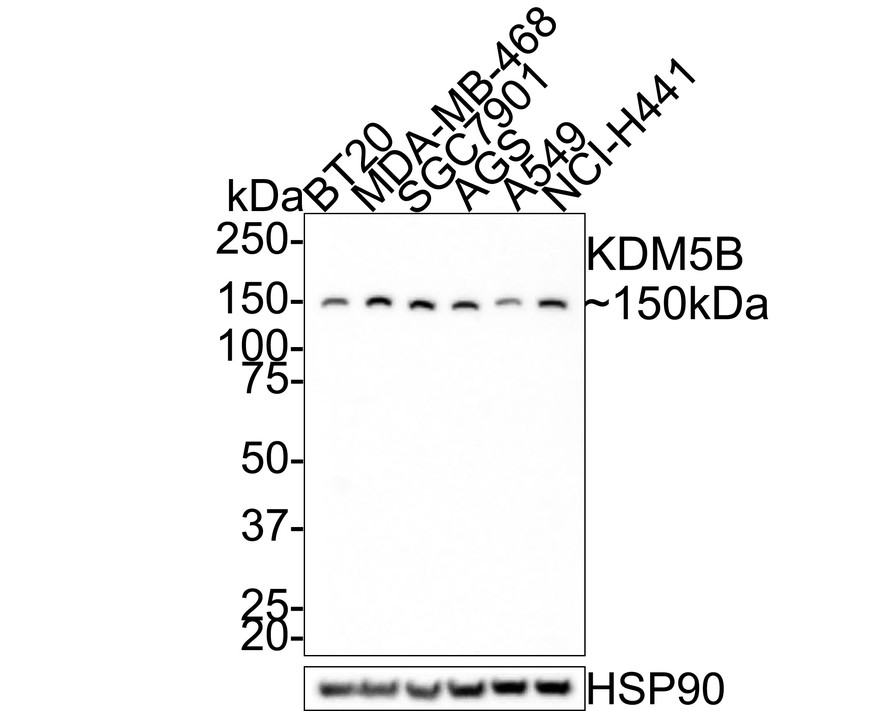 Western blot analysis of KDM5B on different lysates with Rabbit anti-KDM5B antibody (ER1802-21) at 1/1,000 dilution.<br />
<br />
Lane 1: BT-20 cell lysate (16 µg/Lane)<br />
Lane 2: MDA-MB-468 cell lysate (20 µg/Lane)<br />
Lane 3: SGC7901 cell lysate (20 µg/Lane)<br />
Lane 4: AGS cell lysate (20 µg/Lane)<br />
Lane 5: A549 cell lysate (20 µg/Lane)<br />
Lane 6: NCI-H441 cell lysate (20 µg/Lane)<br />
<br />
Predicted band size: 176 kDa<br />
Observed band size: 150 kDa<br />
<br />
Exposure time: 1 minute;<br />
<br />
4-20% SDS-PAGE gel.<br />
<br />
Proteins were transferred to a PVDF membrane and blocked with 5% NFDM/TBST for 1 hour at room temperature. The primary antibody (ER1802-21) at 1/1,000 dilution was used in 5% NFDM/TBST at room temperature for 2 hours. Goat Anti-Rabbit IgG - HRP Secondary Antibody (HA1001) at 1/300,000 dilution was used for 1 hour at room temperature.