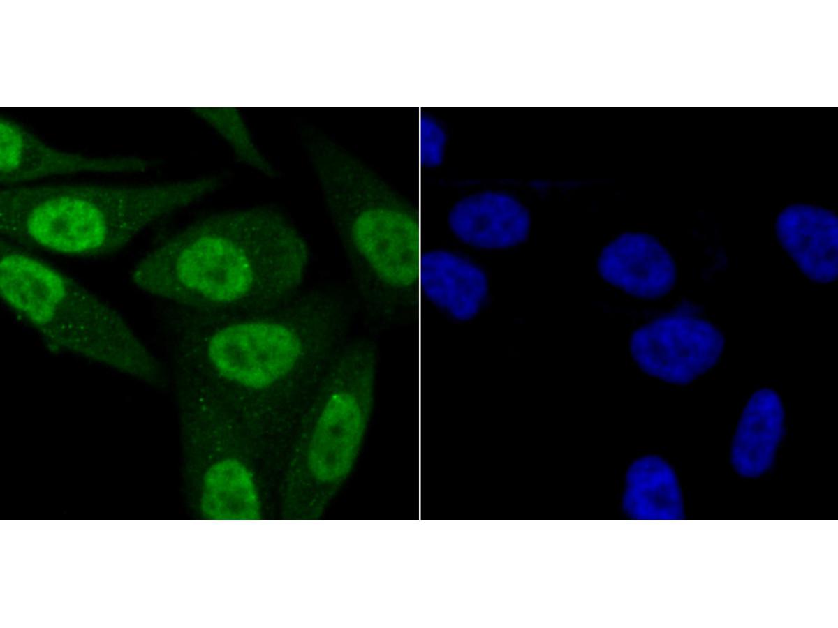 ICC staining KDM5B in PC-3M cells (green). The nuclear counter stain is DAPI (blue). Cells were fixed in paraformaldehyde, permeabilised with 0.25% Triton X100/PBS.
