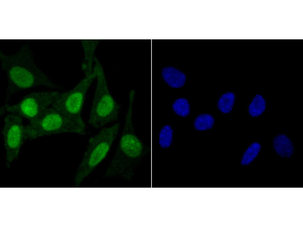 ICC staining KDM5B in SH-SY5Y cells (green). The nuclear counter stain is DAPI (blue). Cells were fixed in paraformaldehyde, permeabilised with 0.25% Triton X100/PBS.