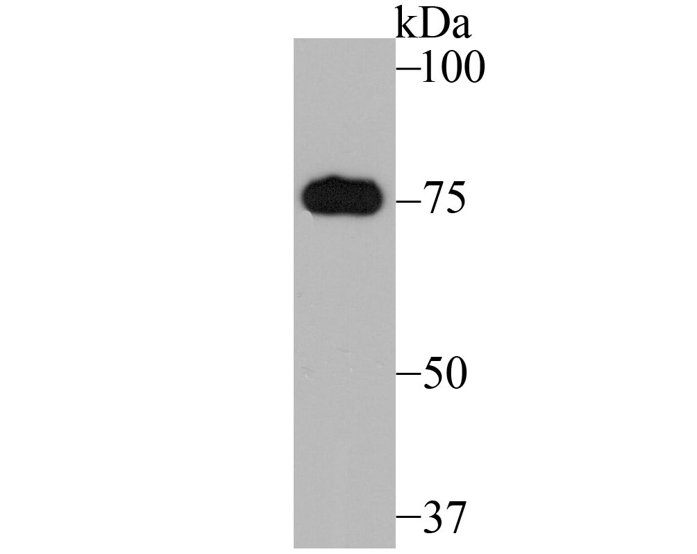 Western blot analysis of Mitofusin 2 on rat heart tissue lysates. Proteins were transferred to a PVDF membrane and blocked with 5% BSA in PBS for 1 hour at room temperature. The primary antibody (ER1802-23, 1/500) was used in 5% BSA at room temperature for 2 hours. Goat Anti-Rabbit IgG - HRP Secondary Antibody (HA1001) at 1:200,000 dilution was used for 1 hour at room temperature.