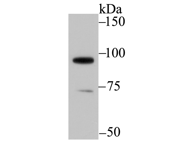 Western blot analysis of SATB1 on mouse thymus tissue lysate using anti-SATB1 antibody at 1/500 dilution.