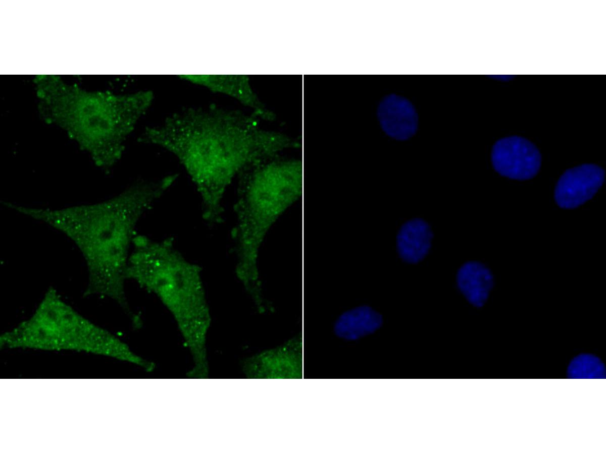 ICC staining SATB1 in SH-SY-5Y cells (green). The nuclear counter stain is DAPI (blue). Cells were fixed in paraformaldehyde, permeabilised with 0.25% Triton X100/PBS.