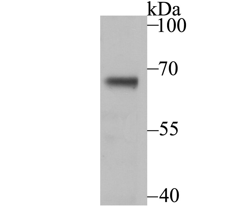 Western blot analysis of USP21 on mouse thymus tissue lysate using anti-USP21 antibody at 1/200 dilution.
