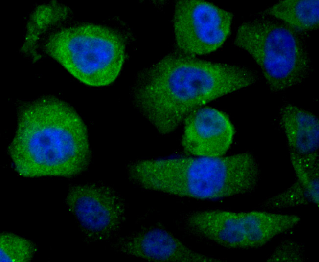 ICC staining USP21 in PC-3M cells (green). The nuclear counter stain is DAPI (blue). Cells were fixed in paraformaldehyde, permeabilised with 0.25% Triton X100/PBS.