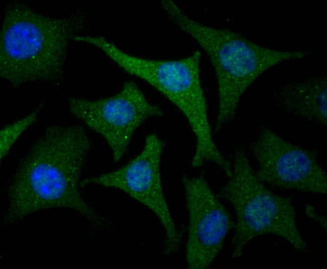 ICC staining USP21 in SH-SY-5Y cells (green). The nuclear counter stain is DAPI (blue). Cells were fixed in paraformaldehyde, permeabilised with 0.25% Triton X100/PBS.