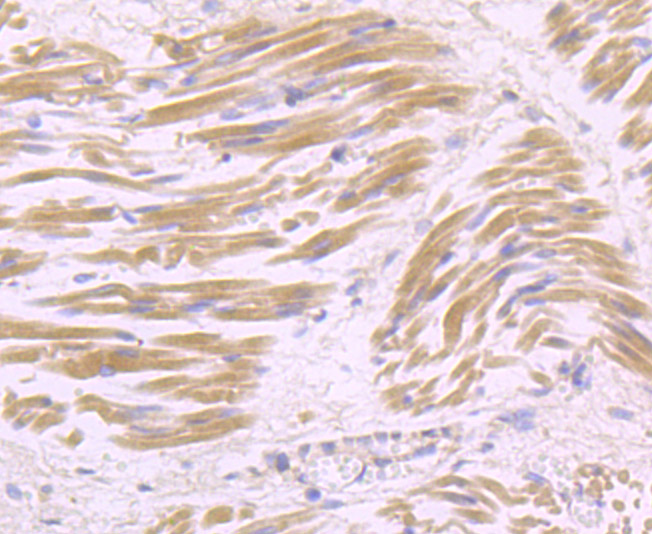 Immunohistochemical analysis of paraffin-embedded human fetal skeletal muscle tissue using anti-USP21 antibody. Counter stained with hematoxylin.