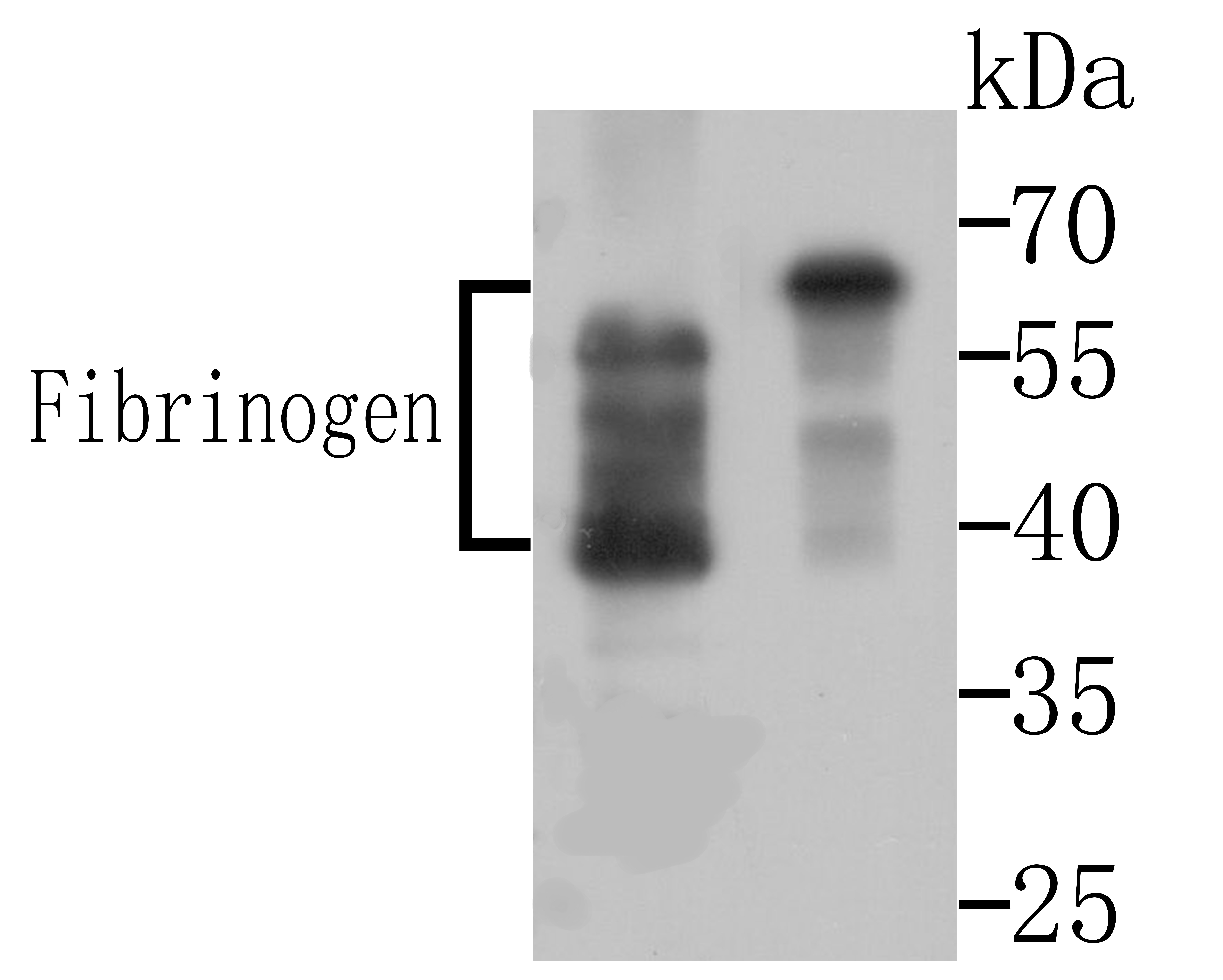 Western blot analysis of Fibrinogen on mouse bone marrow and human kidney tissue lysates using anti-Fibrinogen antibody at 1/500 dilution.