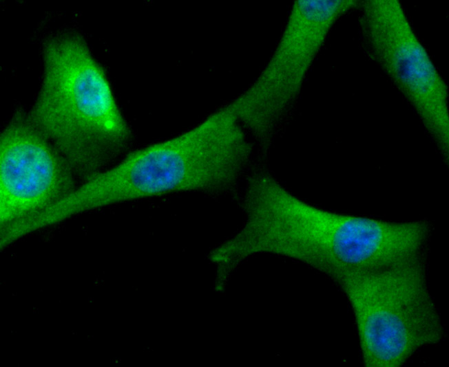 ICC staining Fibrinogen in NIH-3T3 cells (green). The nuclear counter stain is DAPI (blue). Cells were fixed in paraformaldehyde, permeabilised with 0.25% Triton X100/PBS.
