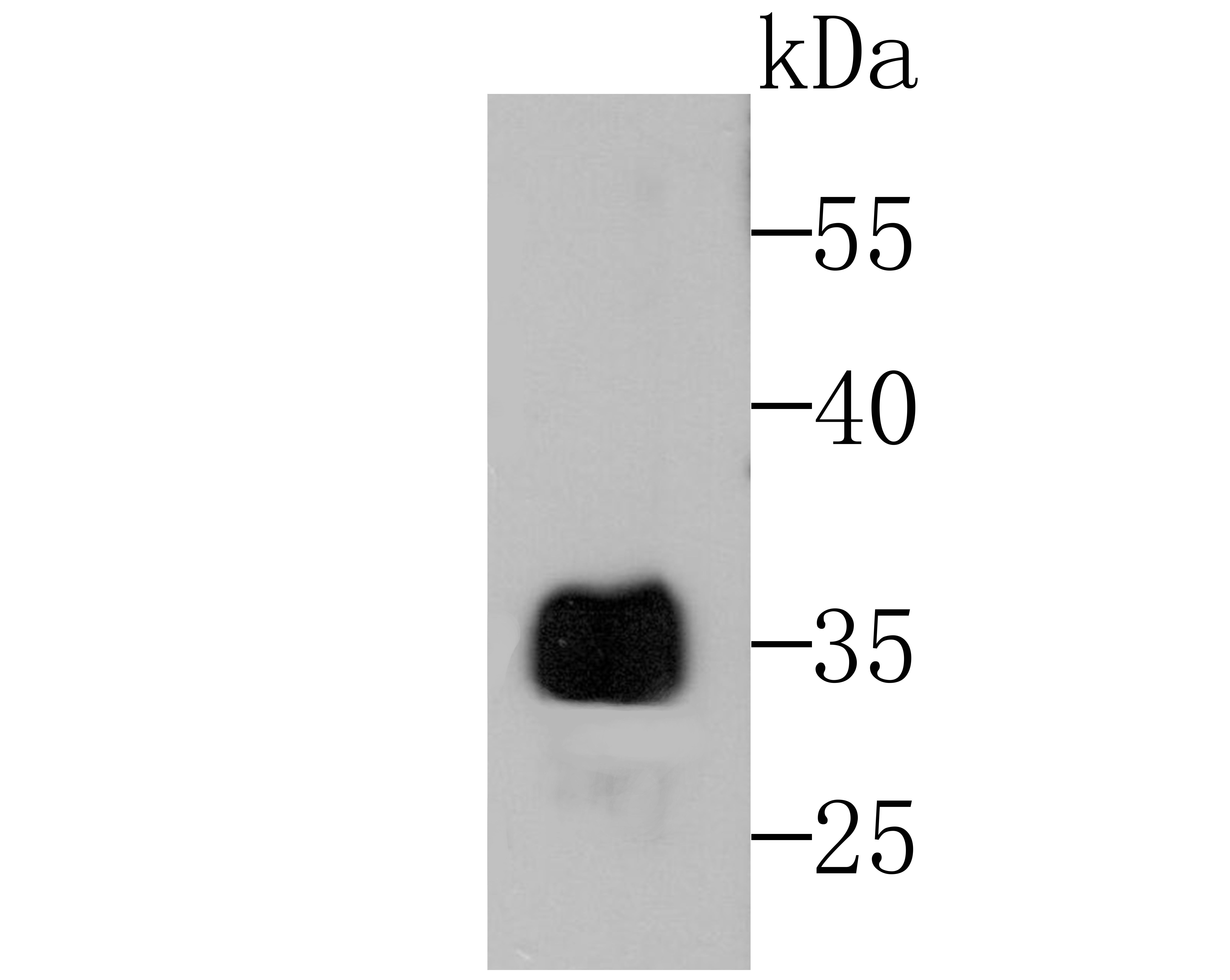 Western blot analysis of Alpha-1 Acid Glycoprotein on human liver tissue lysates using anti-Alpha-1 acid glycoprotein antibody at 1/500 dilution.