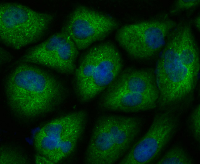 ICC staining CXCR4 in HUVEC cells (green). The nuclear counter stain is DAPI (blue). Cells were fixed in paraformaldehyde, permeabilised with 0.25% Triton X100/PBS.