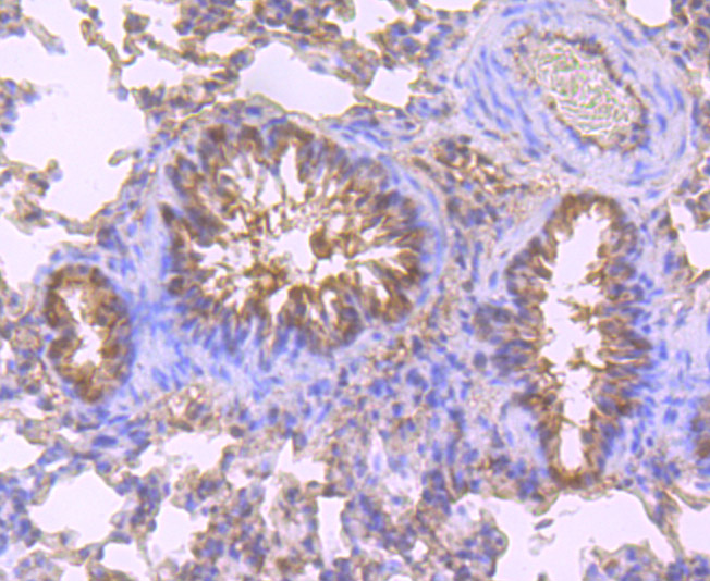 Immunohistochemical analysis of paraffin-embedded rat lung tissue using anti-CXCR4 antibody. Counter stained with hematoxylin.