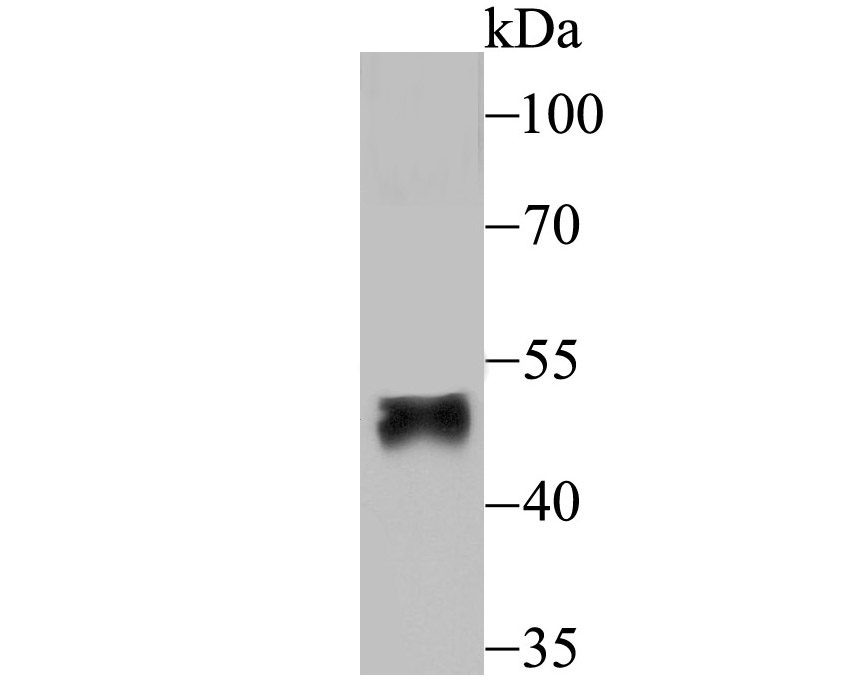Western blot analysis of FOXF2 on human placenta tissue lysate using anti-FOXF2 antibody at 1/200 dilution.