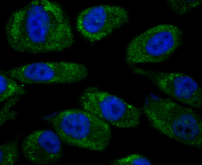 ICC staining Noggin in PC-3M cells (green). The nuclear counter stain is DAPI (blue). Cells were fixed in paraformaldehyde, permeabilised with 0.25% Triton X100/PBS.