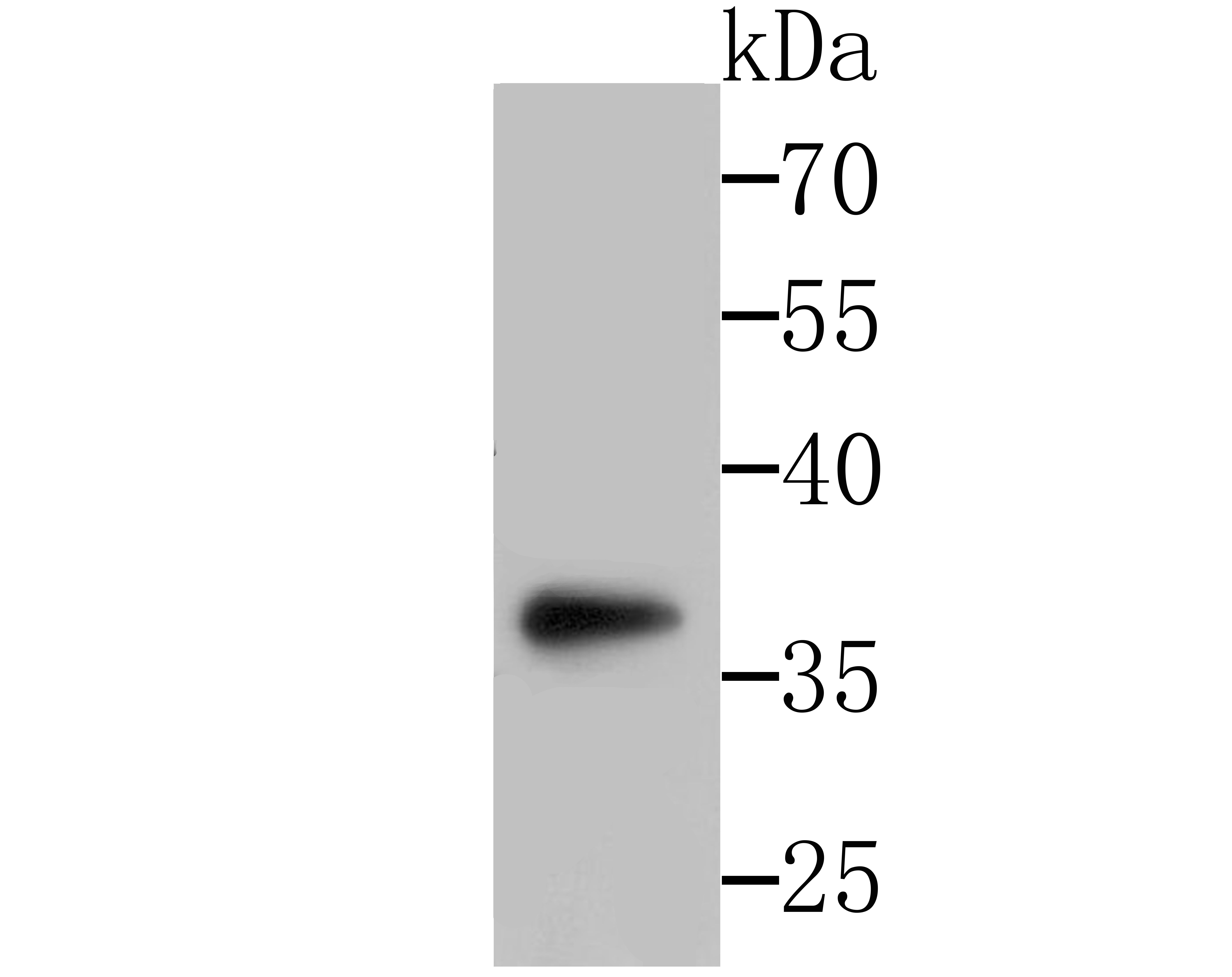 Western blot analysis of SFRP1 on SH-SY-5Y cells lysates using anti-SFRP1 antibody at 1/500 dilution.