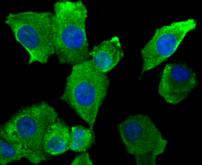 ICC staining SFRP1 in A549 cells (green). The nuclear counter stain is DAPI (blue). Cells were fixed in paraformaldehyde, permeabilised with 0.25% Triton X100/PBS.