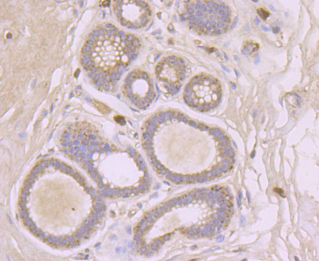 Immunohistochemical analysis of paraffin-embedded human breast tissue using anti-SFRP1 antibody. Counter stained with hematoxylin.
