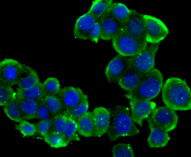 ICC staining PTP1B in LOVO cells (green). The nuclear counter stain is DAPI (blue). Cells were fixed in paraformaldehyde, permeabilised with 0.25% Triton X100/PBS.