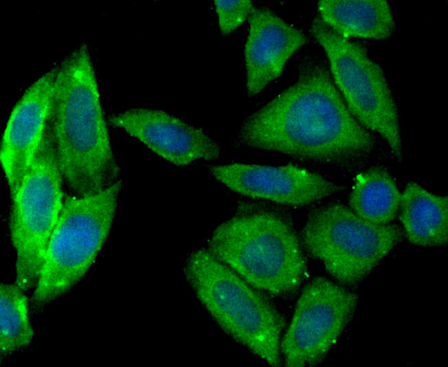 ICC staining PTP1B in Siha cells (green). The nuclear counter stain is DAPI (blue). Cells were fixed in paraformaldehyde, permeabilised with 0.25% Triton X100/PBS.