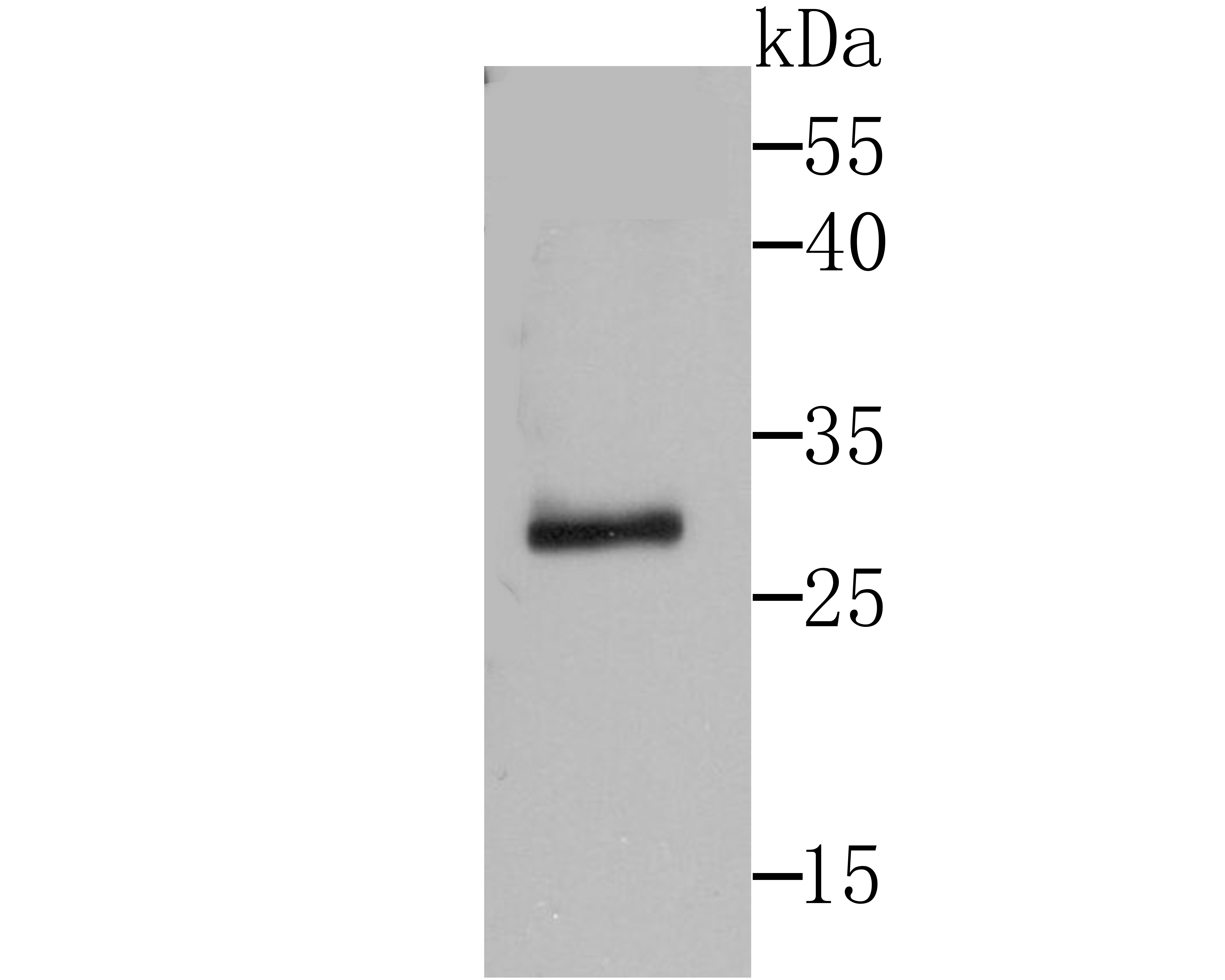 Western blot analysis of IL1 alpha on human lymph node lysates using anti-IL1 alpha antibody at 1/500 dilution.