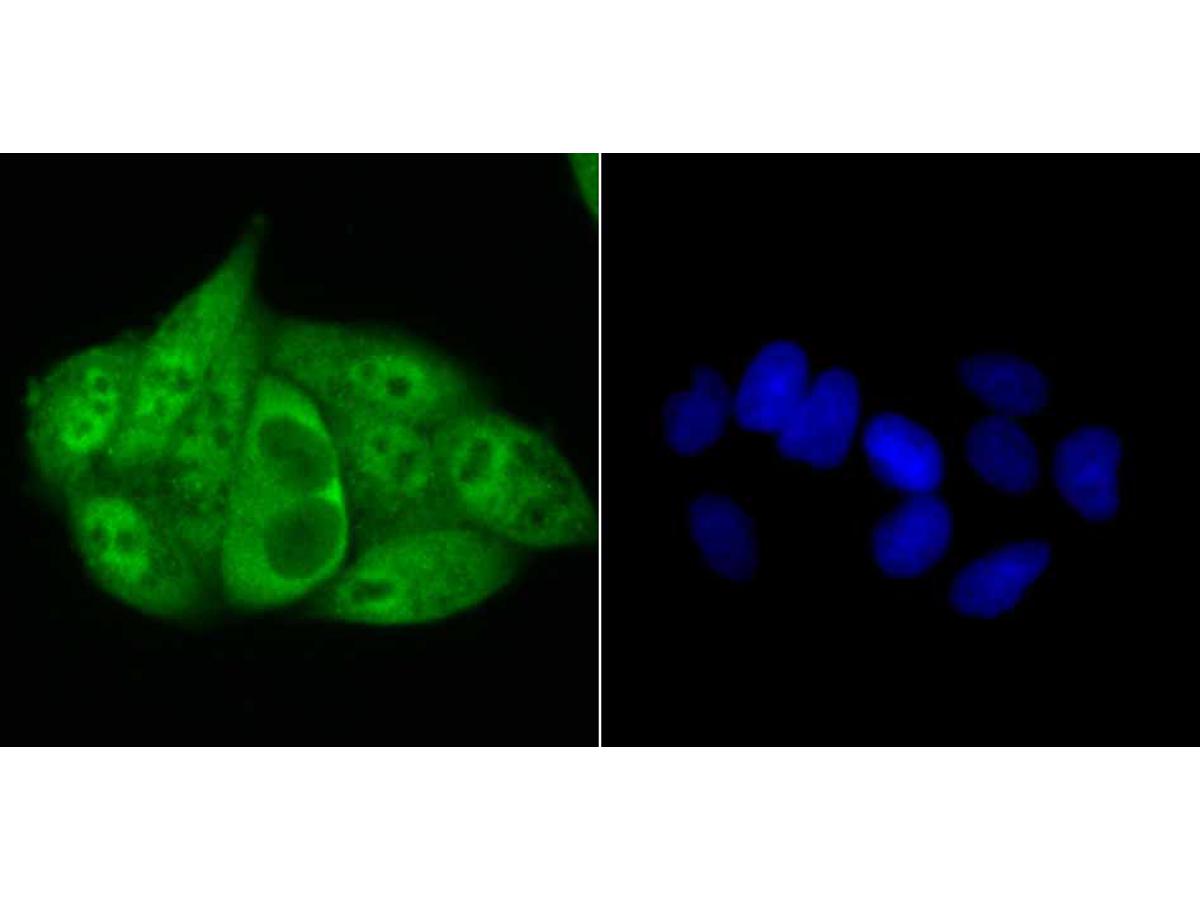 ICC staining Progesterone Receptor in Hela cells (green). The nuclear counter stain is DAPI (blue). Cells were fixed in paraformaldehyde, permeabilised with 0.25% Triton X100/PBS.