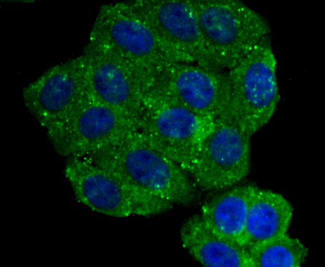 ICC staining Aromatase in HepG2 cells (green). The nuclear counter stain is DAPI (blue). Cells were fixed in paraformaldehyde, permeabilised with 0.25% Triton X100/PBS.