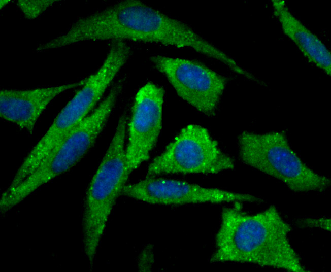 ICC staining Aromatase in SH-SY-5Y cells (green). The nuclear counter stain is DAPI (blue). Cells were fixed in paraformaldehyde, permeabilised with 0.25% Triton X100/PBS.