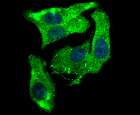 ICC staining Aromatase in SK-Br-3 cells (green). The nuclear counter stain is DAPI (blue). Cells were fixed in paraformaldehyde, permeabilised with 0.25% Triton X100/PBS.