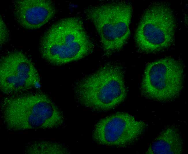 ICC staining APC in HUVEC cells (green). The nuclear counter stain is DAPI (blue). Cells were fixed in paraformaldehyde, permeabilised with 0.25% Triton X100/PBS.