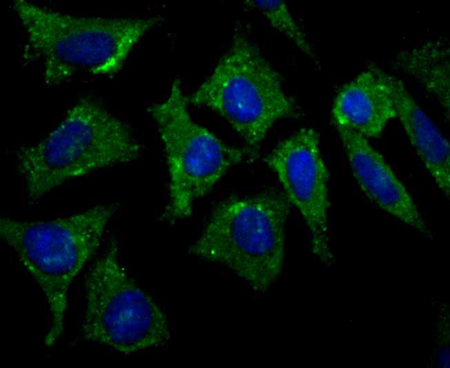 ICC staining APC in SH-SY-5Y cells (green). The nuclear counter stain is DAPI (blue). Cells were fixed in paraformaldehyde, permeabilised with 0.25% Triton X100/PBS.