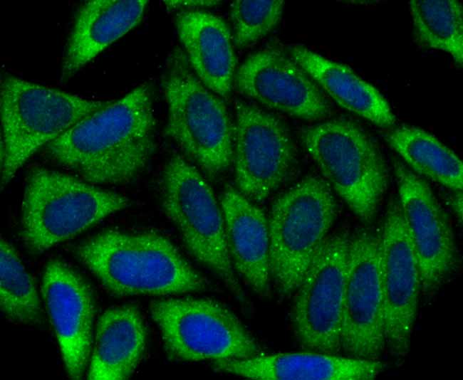 ICC staining APC in SiHa cells (green). The nuclear counter stain is DAPI (blue). Cells were fixed in paraformaldehyde, permeabilised with 0.25% Triton X100/PBS.