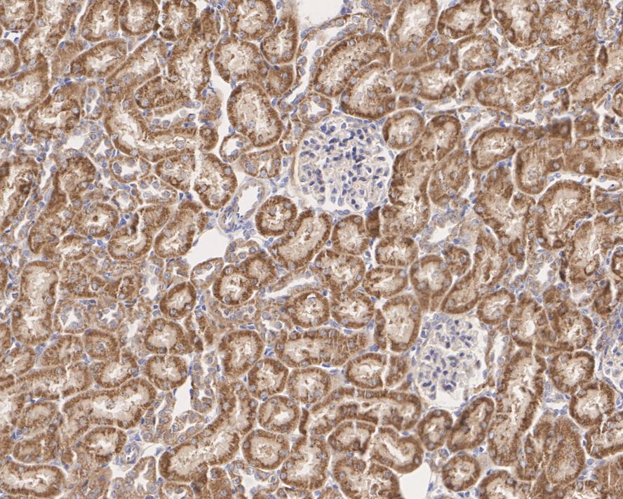 Immunohistochemical analysis of paraffin-embedded human breast tissue using anti-APC antibody. Counter stained with hematoxylin.