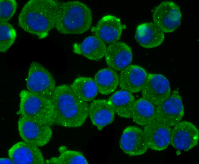 ICC staining IFNA1 in N2A cells (green). The nuclear counter stain is DAPI (blue). Cells were fixed in paraformaldehyde, permeabilised with 0.25% Triton X100/PBS.