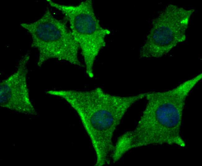ICC staining IFNA1 in SH-SY5Y cells (green). The nuclear counter stain is DAPI (blue). Cells were fixed in paraformaldehyde, permeabilised with 0.25% Triton X100/PBS.