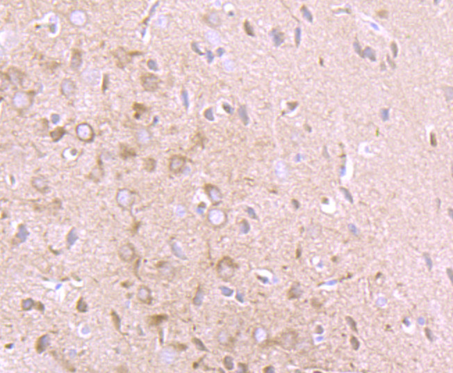 Immunohistochemical analysis of paraffin-embedded rat brain tissue using anti-IFNA1 antibody. Counter stained with hematoxylin.