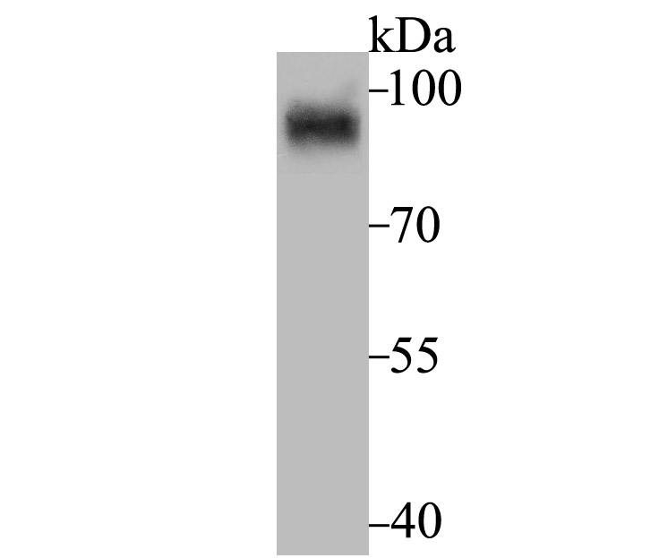 Western blot analysis of HIF-1 alpha on mouse small intestine tissue lysate using anti-HIF-1 alpha antibody at 1/500 dilution.