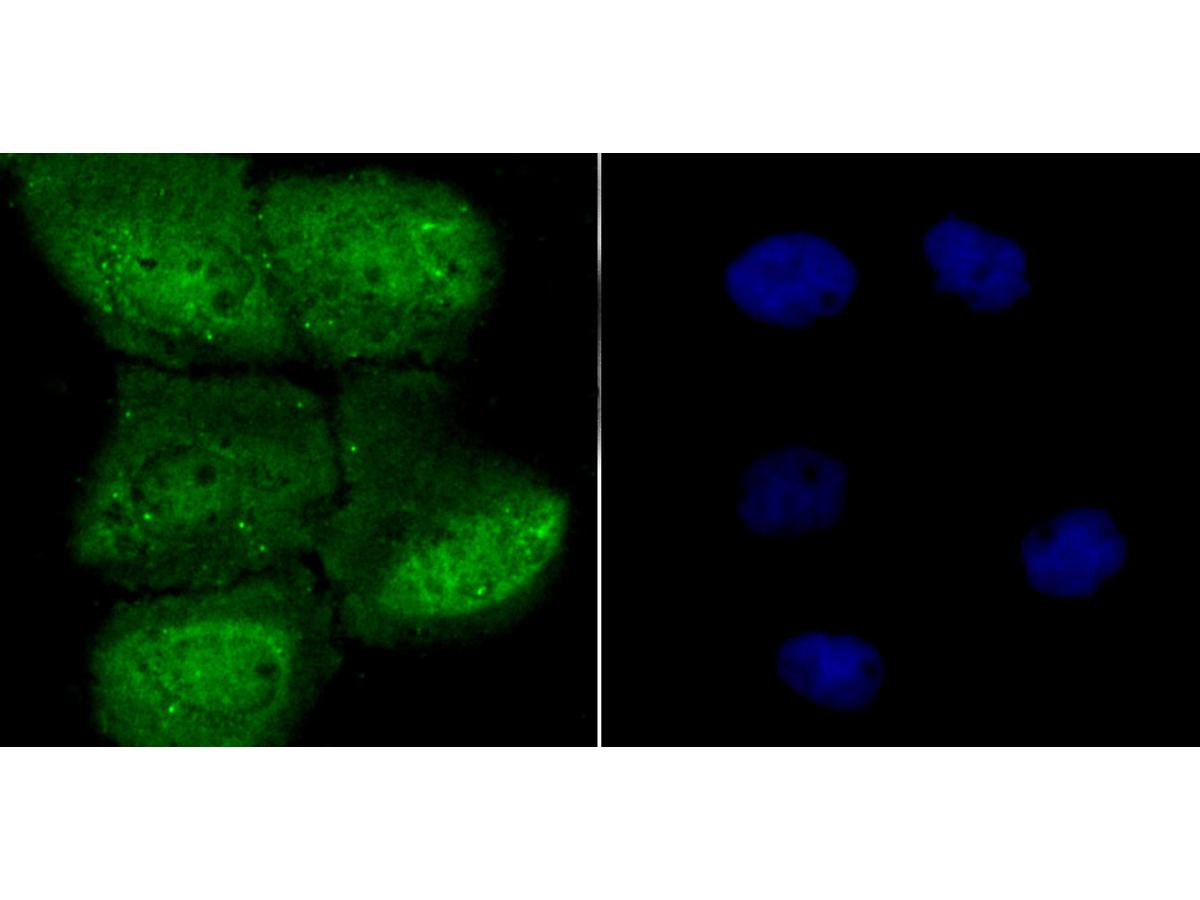 ICC staining HIF-1 alpha in A431 cells (green). The nuclear counter stain is DAPI (blue). Cells were fixed in paraformaldehyde, permeabilised with 0.25% Triton X100/PBS.