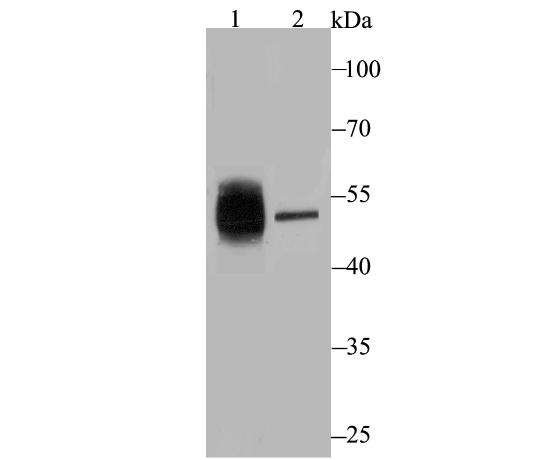 Western blot analysis of Cytokeratin 8 on different lysates using anti-Cytokeratin 8 antibody at 1/500 dilution.<br />
 Positive control:<br />
 Lane 1: Human small intestine<br />
   Lane 2: A431