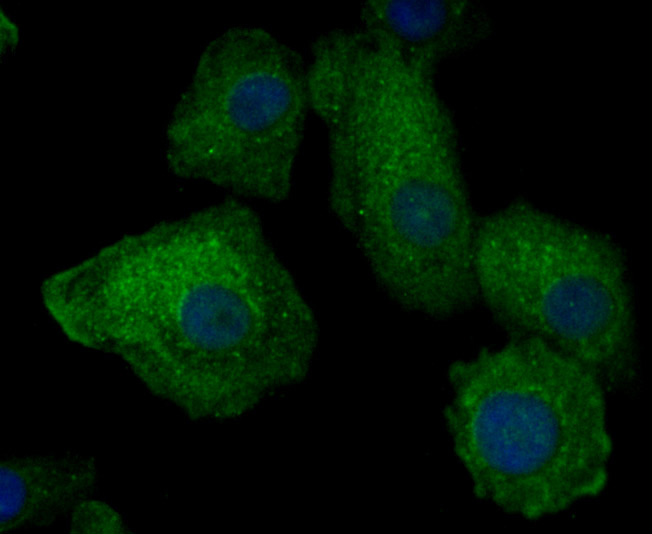 ICC staining Cytokeratin 8 in A549 cells (green). The nuclear counter stain is DAPI (blue). Cells were fixed in paraformaldehyde, permeabilised with 0.25% Triton X100/PBS.