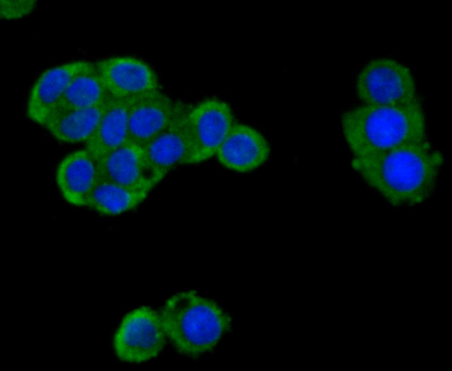 ICC staining Cytokeratin 8 in LOVO cells (green). The nuclear counter stain is DAPI (blue). Cells were fixed in paraformaldehyde, permeabilised with 0.25% Triton X100/PBS.