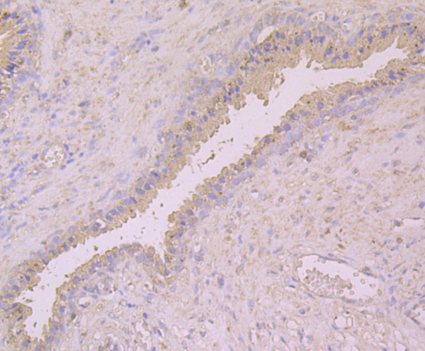 Immunohistochemical analysis of paraffin-embedded human prostate tissue using anti-Cytokeratin 8 antibody. Counter stained with hematoxylin.